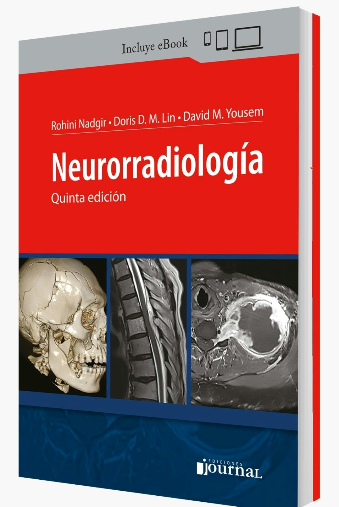 Nadgir Neurorradiología 5ed